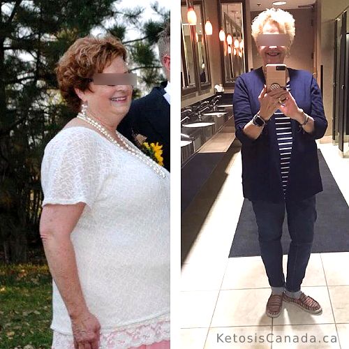 Betty before and after ketones